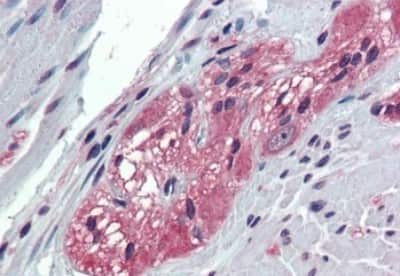 Immunohistochemistry-Paraffin: TXLNB Antibody [NBP3-14510] - Immunohistochemistry of formalin-fixed, paraffin-embedded human colon, ganglion cells, after heat-induced antigen retrieval.
